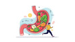 © rasel - Active man runs alongside a large diagram of a human stomach filled with various fresh healthy vegetables like carrots and broccoli.