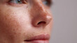 © sa-photo - Close up of freckled skin on face showing natural texture and soft lips