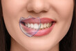 © New Africa - Dental care. Woman with perfect smile, closeup. Teeth under virtual shield whiter than others