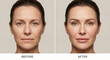 © Максим Новосветлов - Face of middle-aged woman showing before and after skin rejuvenation results with reduced wrinkles and smoother complexion.