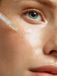 © halcon1 - Close-up of a cosmetic injection being applied to a young woman's face with freckles and glowing skin. Concept of biorevitalization, mesotherapy, and professional aesthetic medicine