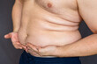 © Aliaksandr - Man holding his belly fat with both hands