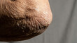 © For You Retouch - Close-up of dry flaky skin on female senior elbow