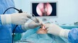 © DavoeAnimation - Surgeons performing endoscopic nasal surgery with a monitor displaying the procedure in the operating room.