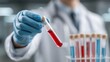© harukazeburm - Medical Professional Holding Test Tube with Blood Sample for Diagnosis and Test Results Analysis