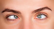 © Volodymyr - Strabismus human eyes macro detail. Strabismus ophthalmic vision disorder concept. Strabismus female facial expression closeup. Strabismus sideways eye look.