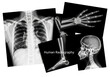 © Kasper - a hyper-detailed, high-contrast collage of four human skeletal radiographs (chest, hand, leg, skull) featuring overlaid text against a sterile white background, emphasizing anatomical complexity