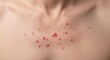 © mdmojibur - A close up view of a person's chest showing signs of acne breakouts and red inflamed skin lesions