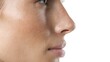© Newleks - Woman's natural skin profile showing melanin spots and textured pores, representing real beauty, skincare, dermatology, health, and authentic complexion on a white background