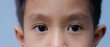 © Sakorn - Close up little Asian  boy's eye with looking straight to the target. Healthy life concept.