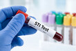 © Meow Creations - Gloved hand holding a red blood sample tube for an sti test in a laboratory