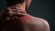 © Keopaserth - Reddened shoulder and neck skin with hand touching painful area, close up of irritated skin and inflammation
