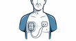 © ayam - Medical device on chest monitoring heart rhythm and activity