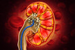© Crystal light - Remove kidney stones. 3d illustration