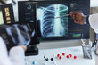 © DragonImages - Doctors reviewing chest X ray on medical monitor, pointing at lung scan data for diagnosis and treatment planning. Ideal for healthcare technology, radiology, AI diagnostics marketing