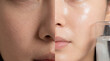 © Thipsuda - Dry skin hydrated skin face close up comparison skincare moisture healthy woman beauty texture water