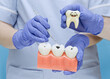 © Maximusdn - Dentist holding a sad crying tooth toy and a dental model with visible cavities. Educational concept for toothache, decay, caries, root canal, and pediatric dentistry.