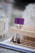 © .shock - Young Middle Eastern doctors and medical technician handling blood test tubes in clinical laboratory setting