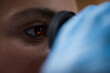 © .shock - Young doctor examining blood sample through microscope eyepiece in medical testing laboratory