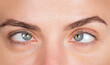 © Volodymyr - Strabismus eyes human macro portrait. Strabismus ophthalmology eye vision concept. Strabismus female face looking sideways. Strabismus eyesight disease observation.