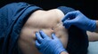 © Katsiaryna - Clinical macro shot of gloved hands preparing spinal diagnostic procedure in hospital setting