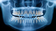 © Jane_S - Panoramic dental x ray showing full adult teeth