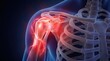 © Jayk - Anatomical illustration of painful shoulder joint with inflamed muscles and bones