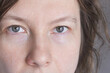 © elenavolf - Woman Eyes Looking Forward Close Up Face Portrait Showing Both Eyes Skin Texture And Neutral Expression With Soft Lighting And Background Visible Hair.