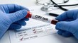 © Mariya Sorvacheva - Medical professional in blue gloves holds a blood sample tube labeled CMV test above a laboratory form with test results and a stethoscope in the background