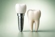 © AkuAku - Dental implant and human tooth shown on a smooth green background for medical illustration