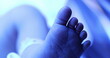 © Marco - Closeup of infant newborn toddler feet under phototherapy