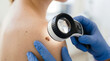 © Cliff - Close-up of dermatologist examining nevus mole on young woman's skin using professional tool, skin cancer prevention and healthcare concept on light background