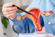 © Антон Скрипачев - Person in a blue shirt uses a black tool on a 3D human reproductive anatomy model. The model shows the uterus, fallopian tubes, and ovaries in detail