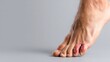 © Ilmi - Mild Skin Injury with Discoloration on a Human Foot and Cleansing Concept for Medical Use