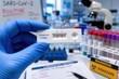 © jawad - Positive COVID-19 antigen rapid test held by gloved hand, medical laboratory setting with SARS-CoV-2 diagnostic equipment and biohazard warning