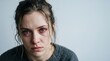 © Iin - close up of crying young woman face with red bloodshot eyes for depression and mental health concept