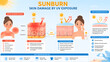 © May - Medical Vector Infographic of UV Sunburn Skin Damage and Sunscreen Protection Concept