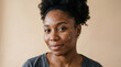 © Jafree - Young african american woman with hyperpigmentation and age spots, close-up portrait showcasing natural beauty and skin diversity