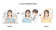 © pravita - Skin betterment process: Before, during consultation, and after results