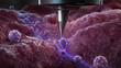 © Chanita - Fascinating microscopic scanning probe analyzing purple tissue tumor for advanced medical science research targeting abnormal cell biology with precise penetrating drug carrier