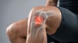 © Muhammed - Knee Ligament Injury and ACL Tear Pain Medical Anatomy Illustration