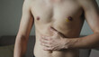 © Shafqat - Shirtless Man Holding His Stomach Suffering from Abdominal Pain