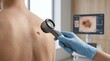 © Helen - Dermatologist examines skin mole on patient back using dermatoscope in modern medical clinic with digital imaging screen