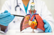© Warawan - Pneumonia, lung cancer, Asian doctor holding human anatomy model for study diagnosis and treatment in hospital.