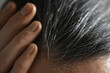 © TrueShot | Westend61 - Hand touching gray hair at the hairline during aging process
