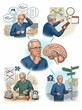 © 2Blurry - Illustration of elderly male patient experiencing cognitive decline Alzheimer disease and memory loss