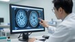 © SR Creative Media - Doctor analyzing brain scans on computer screen in medical lab
