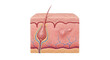 © Boreal - Detailed cross section of human skin showing hair follicle epidermis dermis and subcutaneous layer