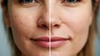 © spyrakot - Female face divided to show enlarged pores and smooth skin comparison