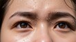 © ArtMajestic - Asian woman patient sweating profusely with feverish eyes suffering from illness. Medical emergency and infectious disease awareness